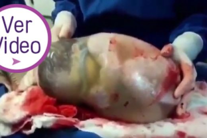 Hermoso video de bebé que nace en su saco amniótico