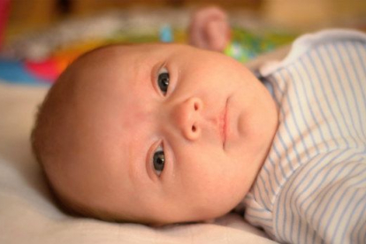 Las hernias más frecuentes en los bebés