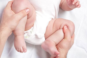 Displasia de cadera en bebés